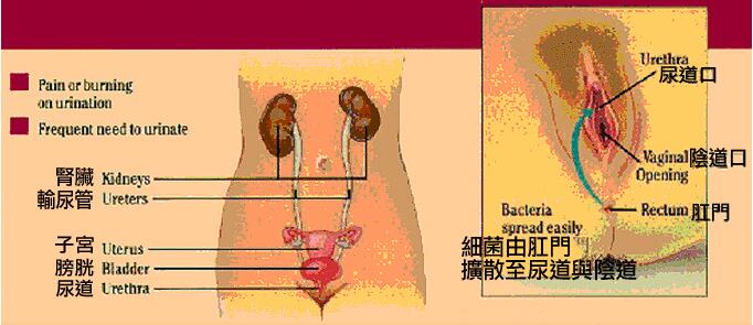 阴道炎为何会一再復发?