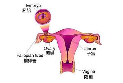 阴道出血诊断方法有哪些?