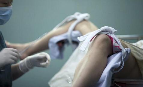 药流注意事项有哪些